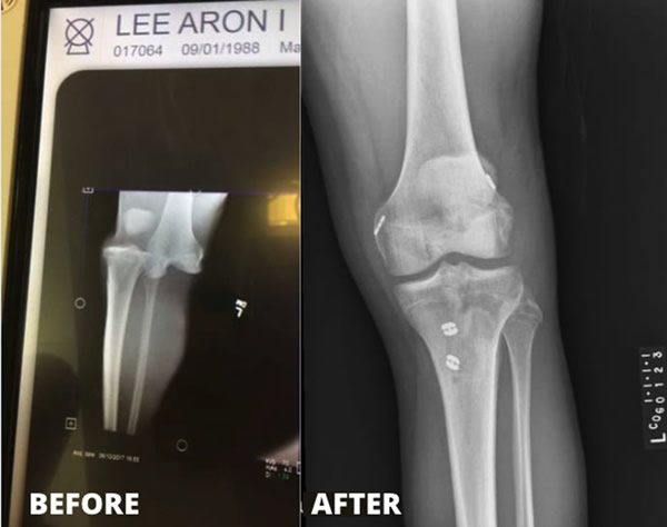 See How Much Damage a Softball Can Do!