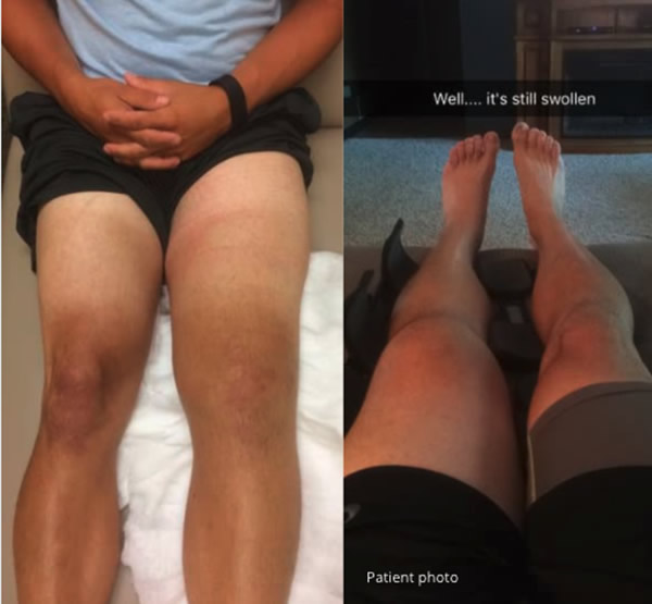 See How Much Damage a Softball Can Do!