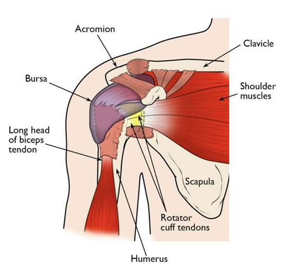 Partial Shoulder Replacement
